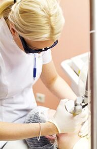 Ein Arzt führt ein Photothermolyseverfahren durch.