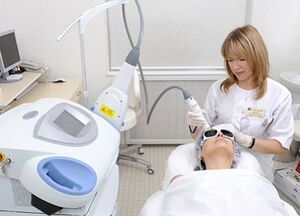 Vor- und Nachteile der fraktionierten Laser-Gesichtshauterneuerung