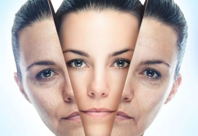 Der Prozess der Entfernung der Gesichtshaut von altersbedingten Veränderungen. 